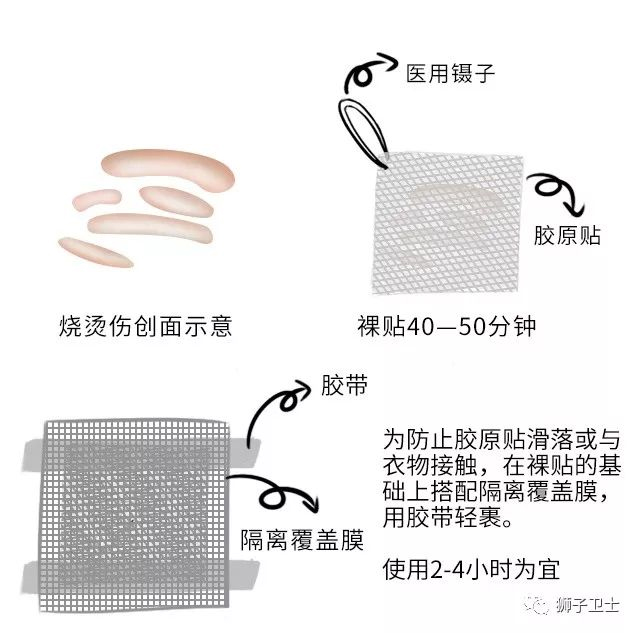 狮子卫士胶原原液贴